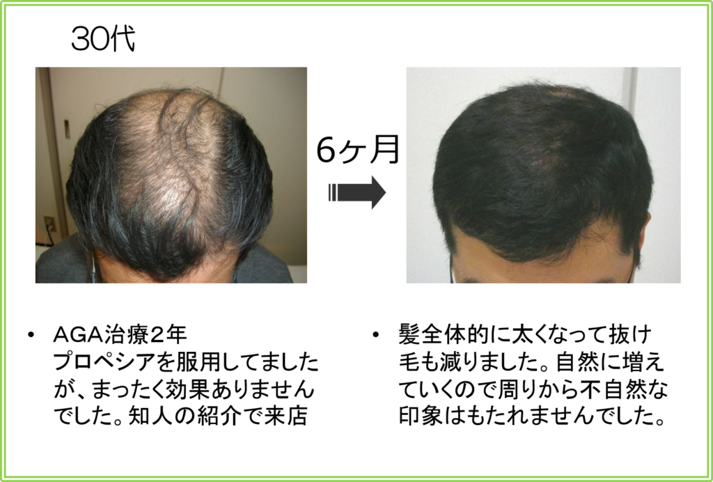 口コミ（お客様の声）30代