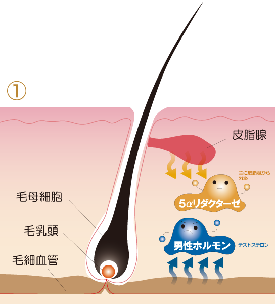 脱毛のメカニズム1