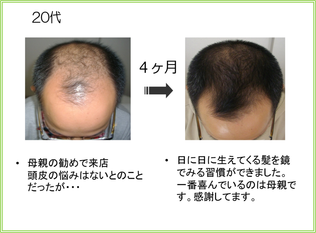 口コミ（お客様の声）20代