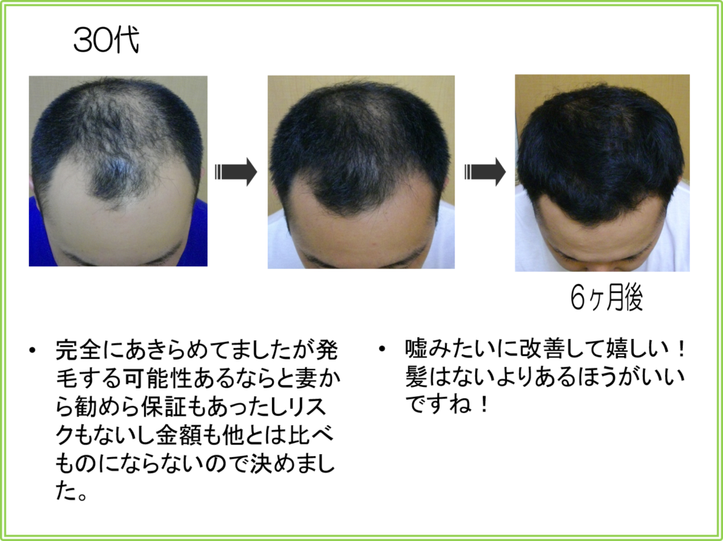 口コミ（お客様の声）30代