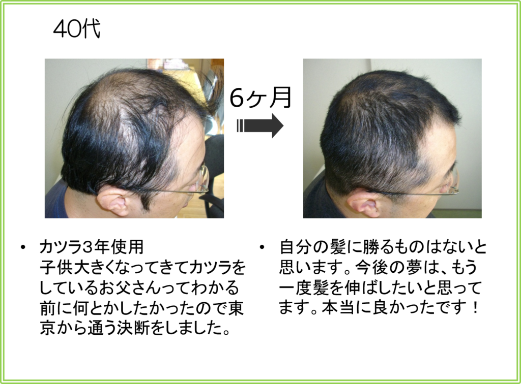 口コミ（お客様の声）40代