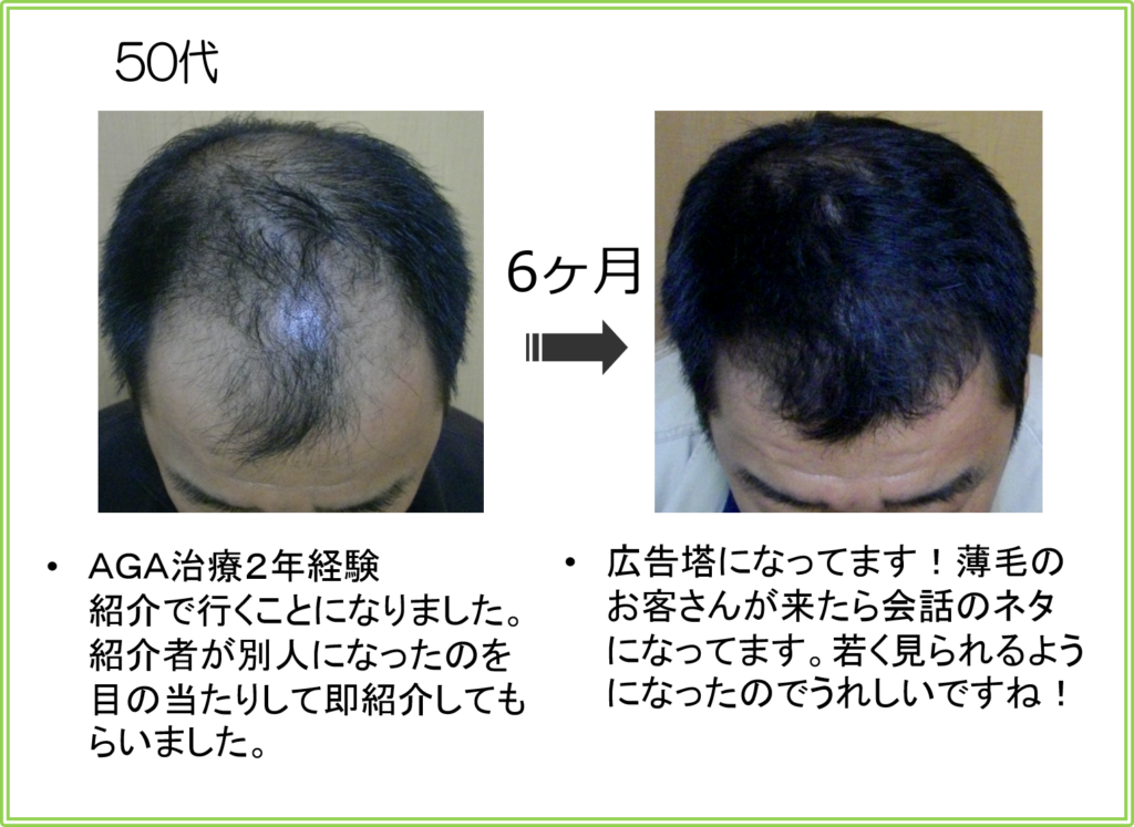 口コミ（お客様の声）50代