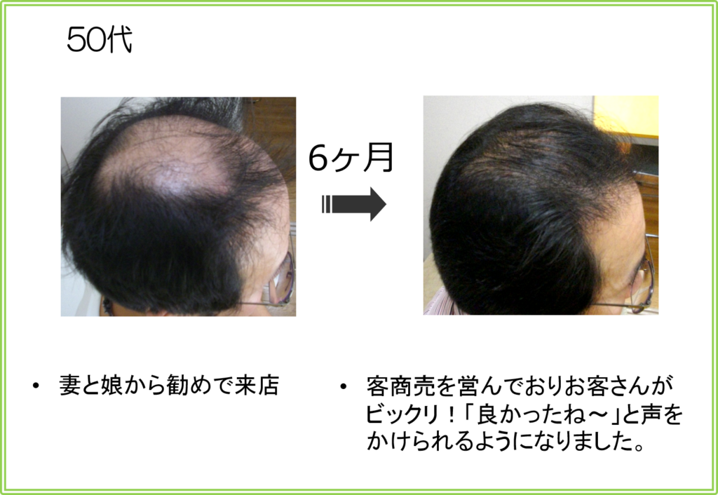 口コミ（お客様の声）50代