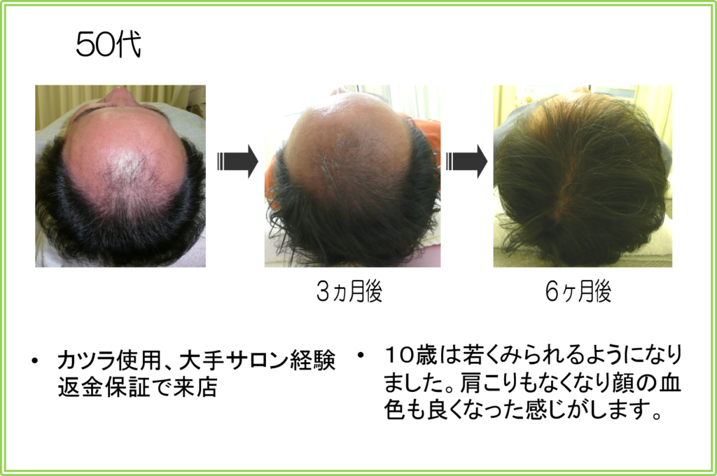 口コミ（お客様の声）50代