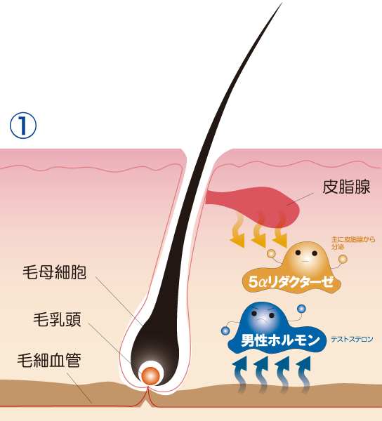 AGA（エージーエー）とは